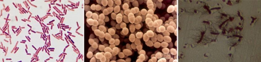 Sticchi di Escherichia, Fäkal- und Pro -Enterococcus - die Hauptpathogene der chronischen bakteriellen Prostatitis