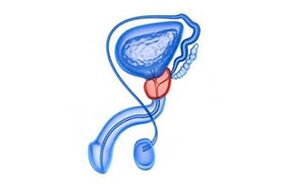 Zeichnung einer Prostataentzündung